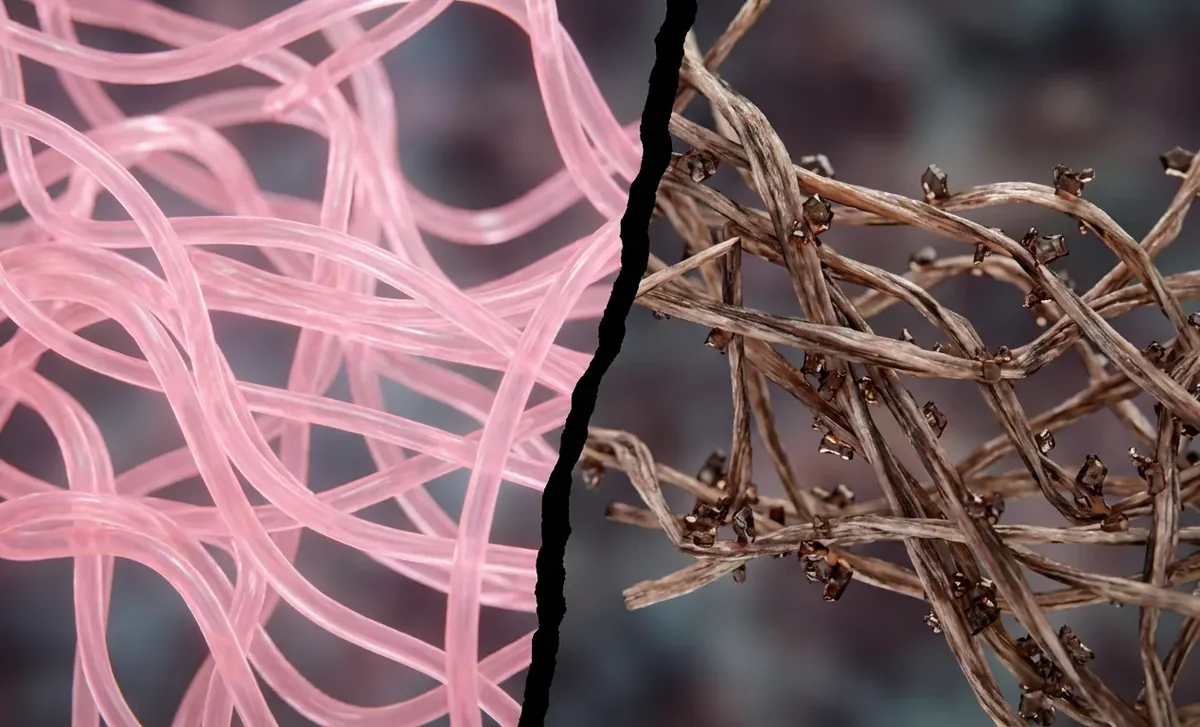Illustration éditoriale — Glycation et peau